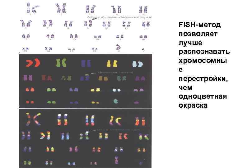 FISH-метод позволяет лучше распознавать хромосомны е перестройки, чем одноцветная окраска 