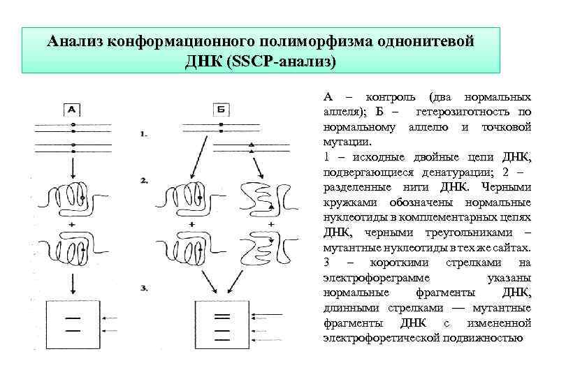 Анализ конформационного полиморфизма однонитевой ДНК (SSCP-анализ) A – контроль (два нормальных аллеля); Б –