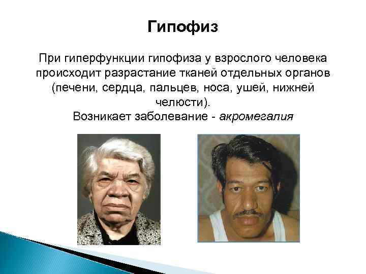 Гипофиз При гиперфункции гипофиза у взрослого человека происходит разрастание тканей отдельных органов (печени, сердца,