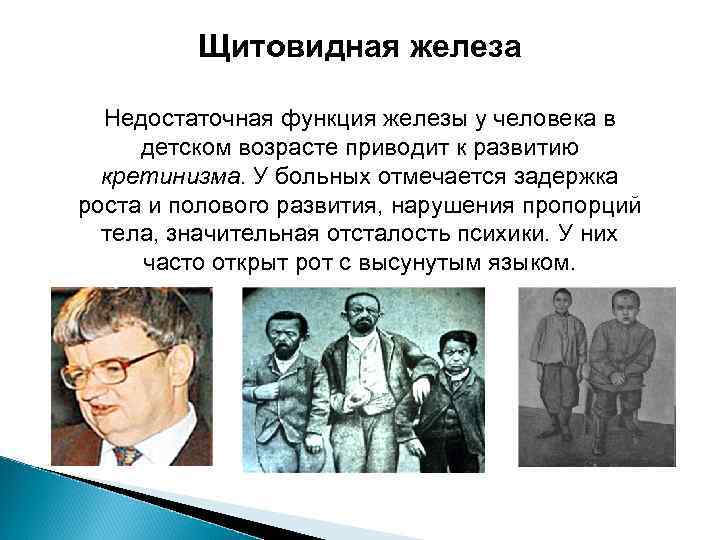 Щитовидная железа Недостаточная функция железы у человека в детском возрасте приводит к развитию кретинизма.