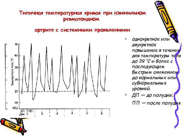 Типичная температурная кривая при ювенильном ревматоидном артрите с системными проявлениями • • однократное или