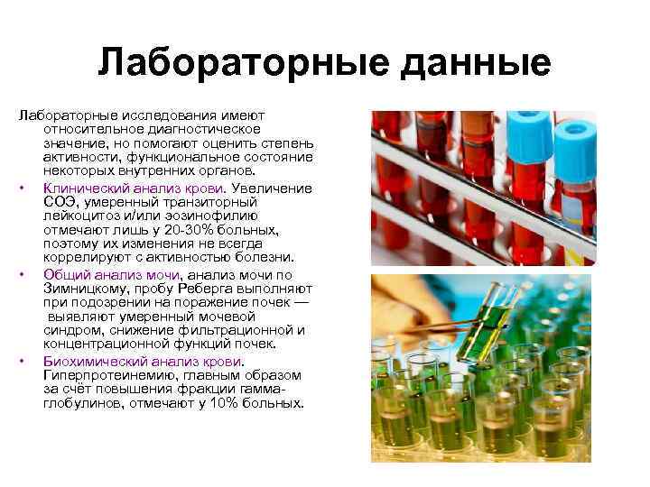Лабораторные данные Лабораторные исследования имеют относительное диагностическое значение, но помогают оценить степень активности, функциональное