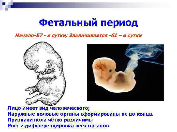 Фетальный период Начало-57 - е сутки; Заканчивается -61 – е сутки Лицо имеет вид