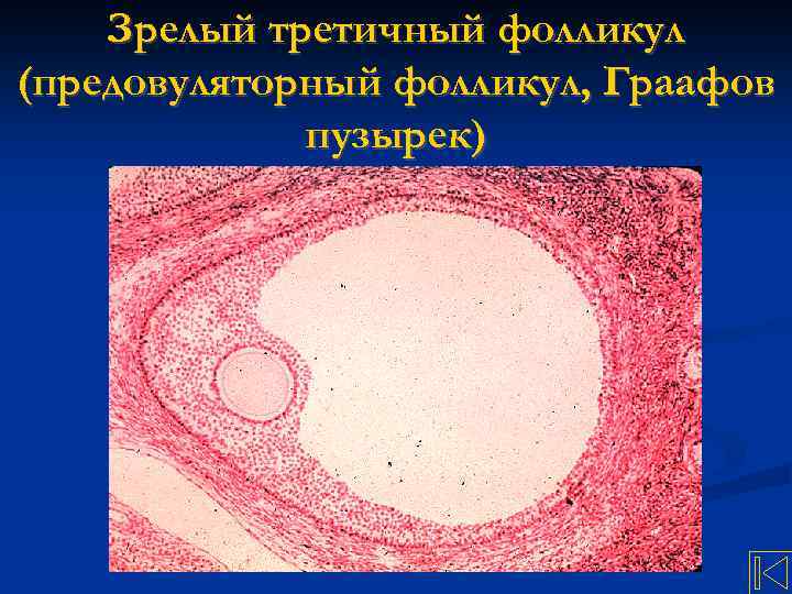 Зрелый третичный фолликул (предовуляторный фолликул, Граафов пузырек) 