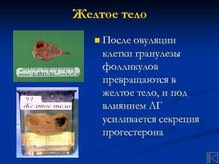 Желтое тело После овуляции клетки гранулезы фолликулов превращаются в желтое тело, и под влиянием