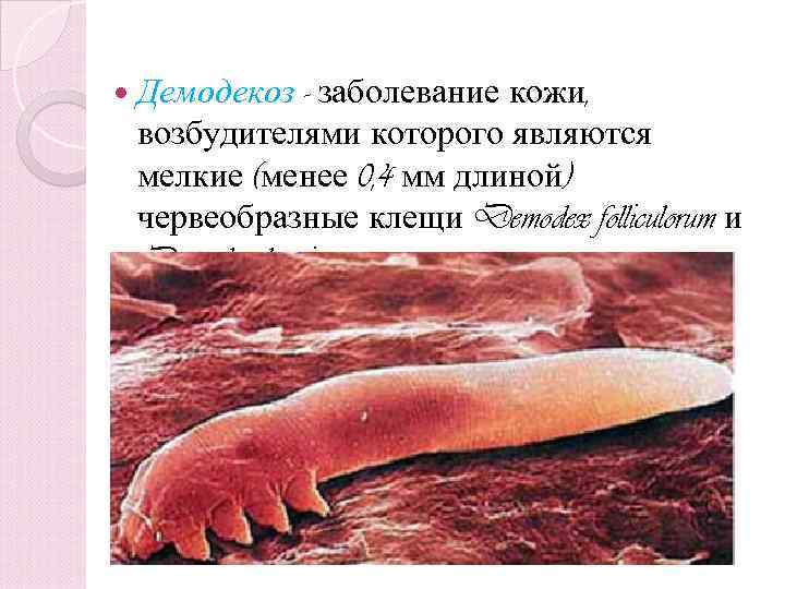 - заболевание кожи, возбудителями которого являются мелкие (менее 0, 4 мм длиной) червеобразные клещи