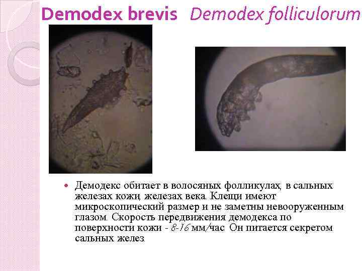 Demodex brevis Demodex folliculorum brevis Демодекс обитает в волосяных фолликулах, в сальных железах кожи,