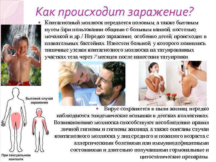 Как происходит заражение? Контагиозный моллюск передается половым, а также бытовым путем (при пользовании общими