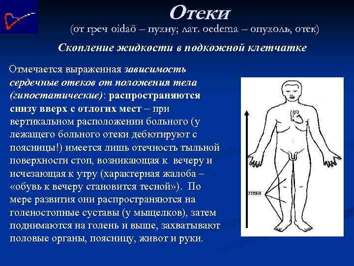 Отеки (от греч oidaõ – пухну; лат. oedema – опухоль, отек) Скопление жидкости в