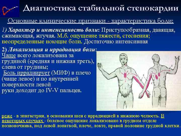 Диагностика стабильной стенокардии Основные клинические признаки - характеристика боли: 1) Характер и интенсивность боли: