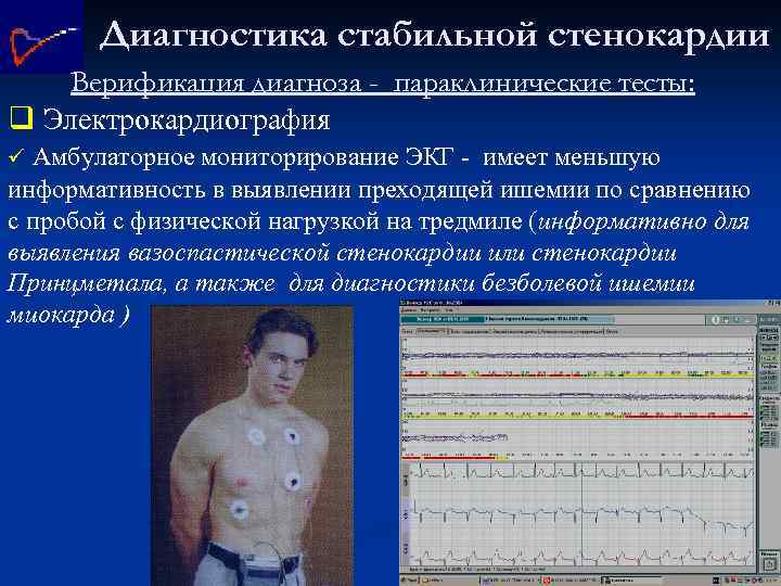 Диагностика стабильной стенокардии Верификация диагноза - параклинические тесты: q Электрокардиография ü Амбулаторное мониторирование ЭКГ