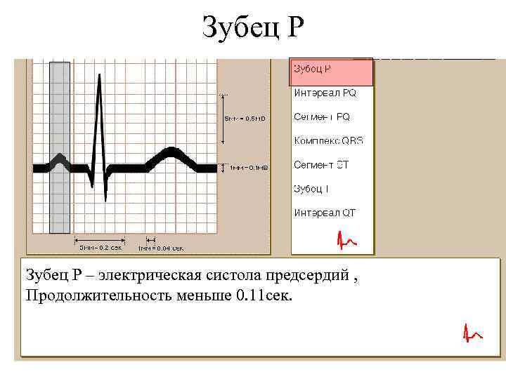 Зубец Р – электрическая систола предсердий , Продолжительность меньше 0. 11 сек. 