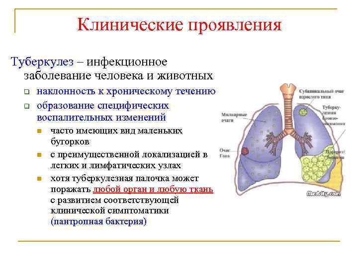 Клинические проявления Туберкулез – инфекционное заболевание человека и животных q q наклонность к хроническому