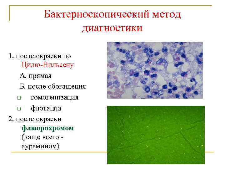 Бактериоскопический метод диагностики 1. после окраски по Цилю-Нильсену А. прямая Б. после обогащения q