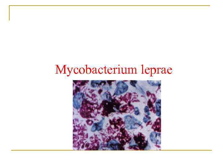 Mycobacterium leprae 