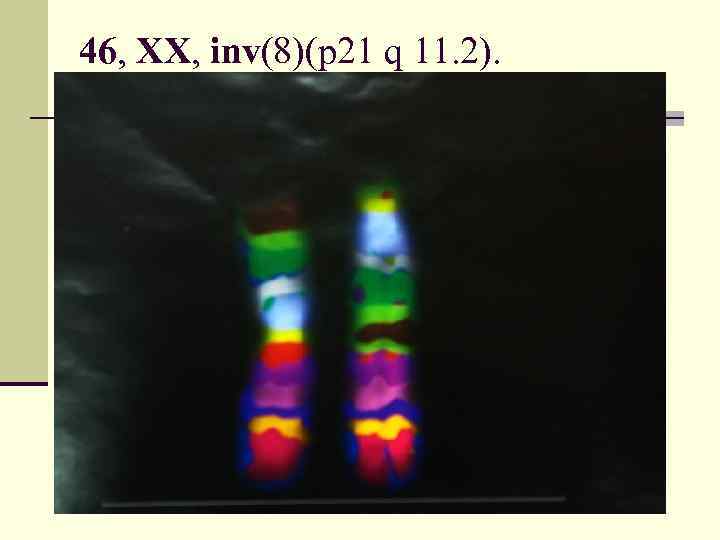 46, XX, inv(8)(p 21 q 11. 2). 