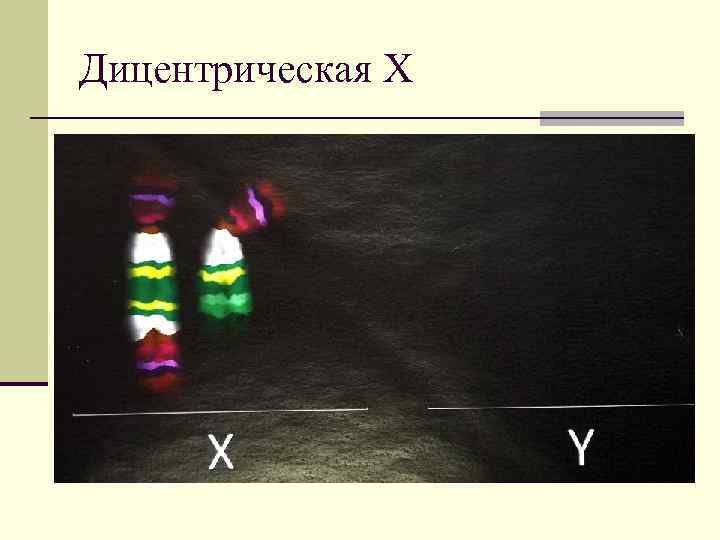 Дицентрическая Х 