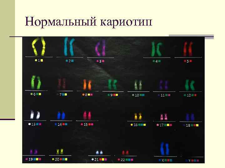 Нормальный кариотип 
