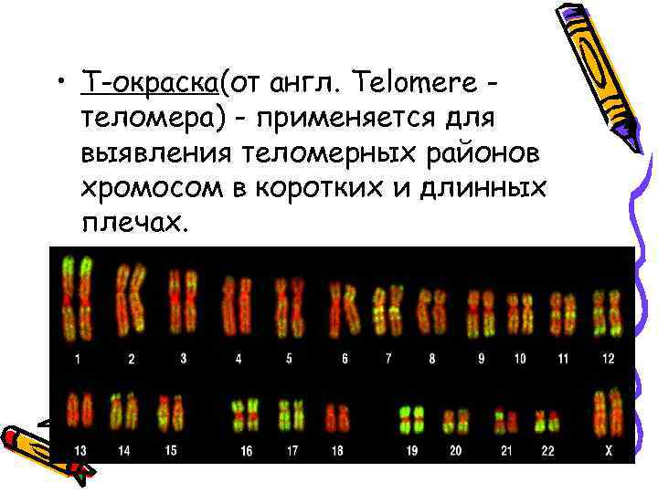  • Т-окраска(от англ. Telomere теломера) - применяется для выявления теломерных районов хромосом в