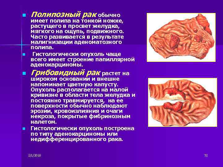 Болезни органов пищеварения презентация