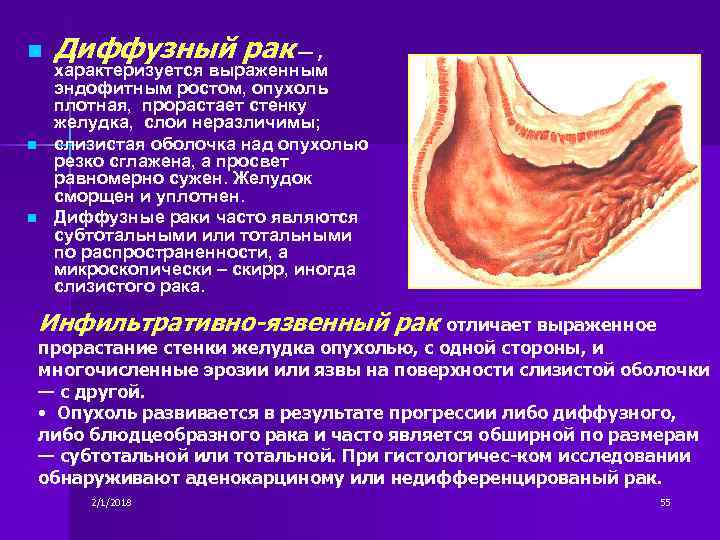 Болезни органов пищеварения презентация