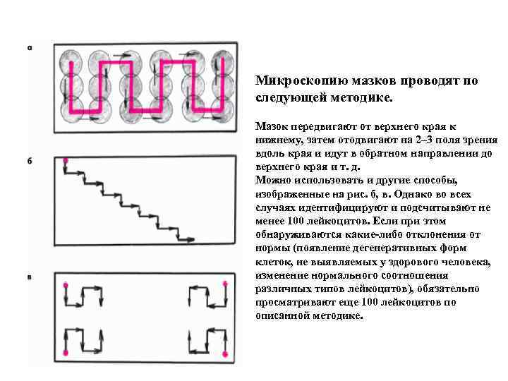 Микроскопию мазков проводят по следующей методике. Мазок передвигают от верхнего края к нижнему, затем