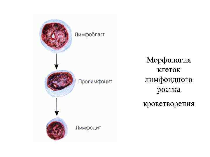 Морфология клеток лимфоидного ростка кроветворения 