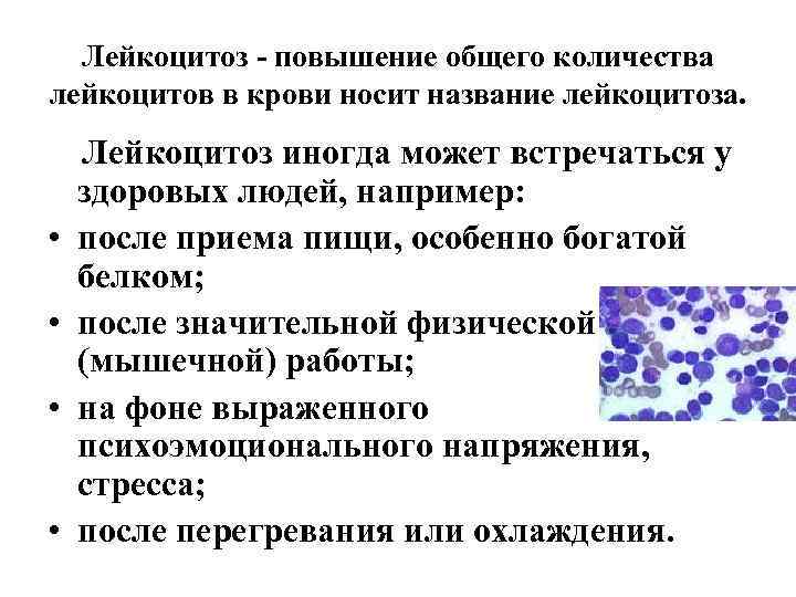 Лейкоцитоз - повышение общего количества лейкоцитов в крови носит название лейкоцитоза. • • Лейкоцитоз