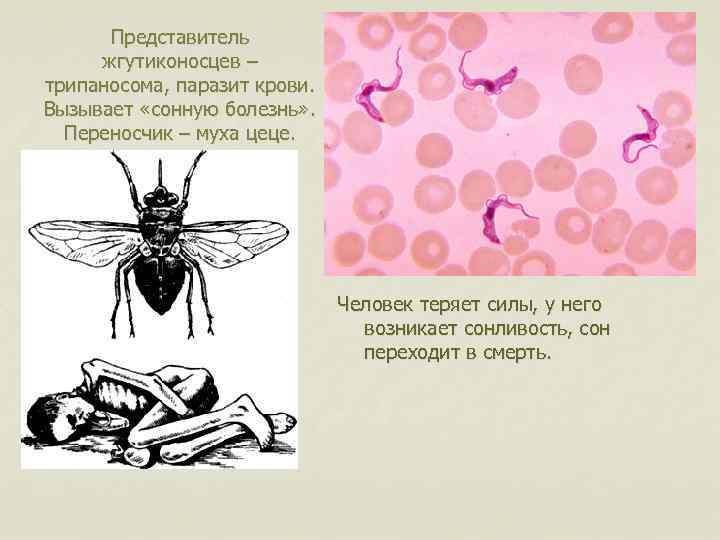 Представитель жгутиконосцев – трипаносома, паразит крови. Вызывает «сонную болезнь» . Переносчик – муха цеце.