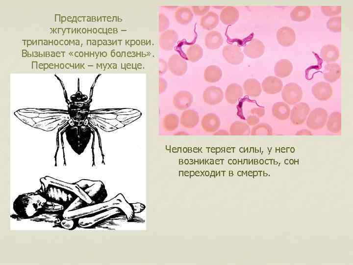 Сонная болезнь. Сонная болезнь Муха ЦЕЦЕ. Муха ЦЕЦЕ ротовой аппарат. Муха це-це переносчик трипаносомы.