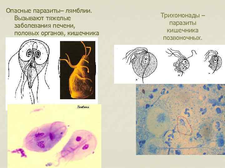 Лямблия картинка с обозначениями