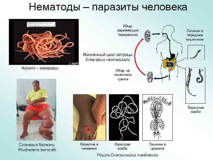 Нематоды – паразиты человека Яйца, заражающие перорально Личинки в переднем кишечнике Жизненный цикл острицы