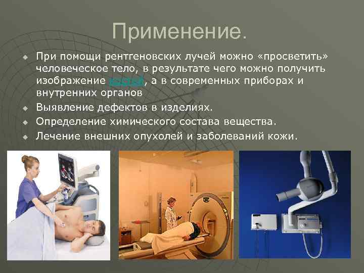 Применение рентгеновского излучения в медицине проект