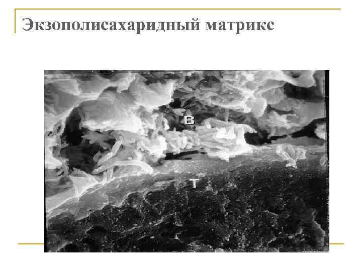 Экзополисахаридный матрикс 