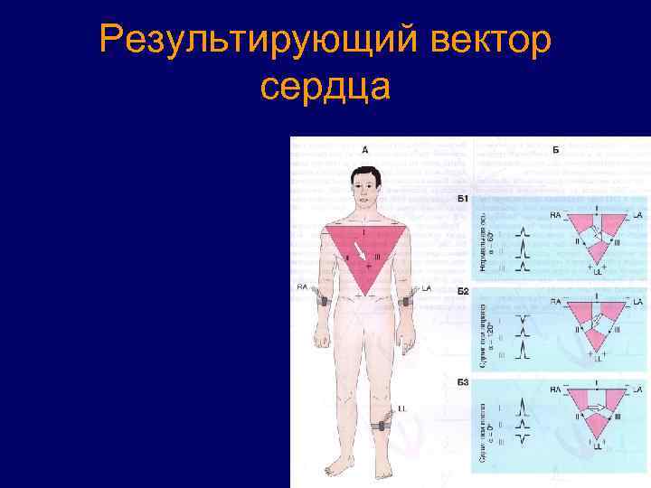 Результирующий вектор сердца 