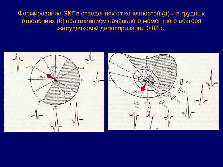 Формирование ЭКГ в отведениях от конечностей (а) и в грудных отведениях (б) под влиянием