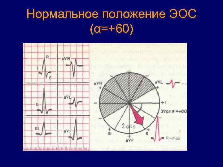 Нормальное положение ЭОС (α=+60) 
