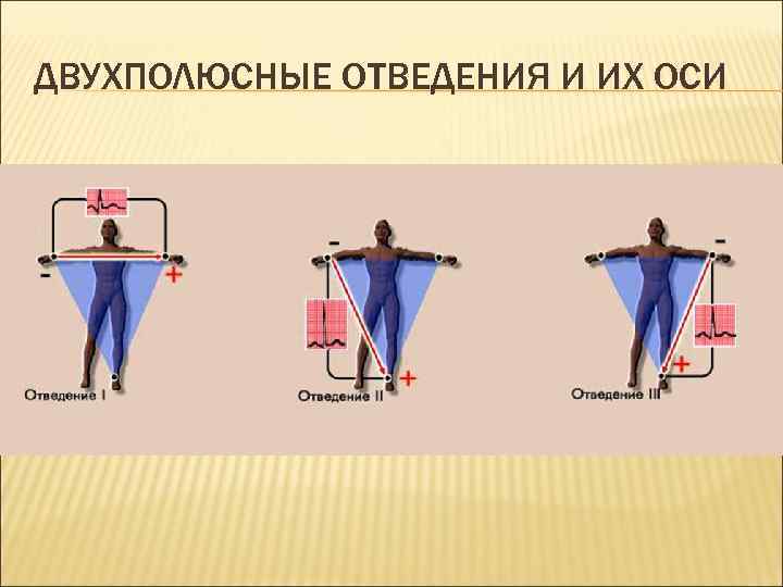 ДВУХПОЛЮСНЫЕ ОТВЕДЕНИЯ И ИХ ОСИ 