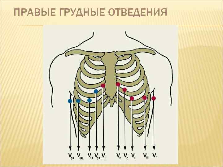 ПРАВЫЕ ГРУДНЫЕ ОТВЕДЕНИЯ 