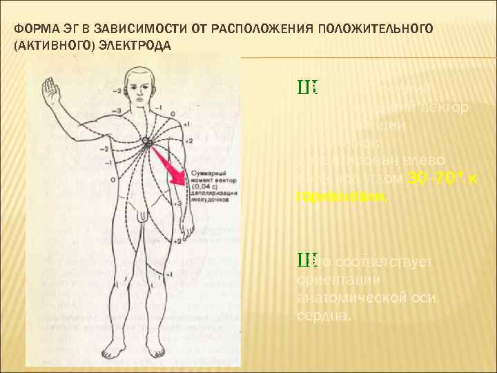 ФОРМА ЭГ В ЗАВИСИМОСТИ ОТ РАСПОЛОЖЕНИЯ ПОЛОЖИТЕЛЬНОГО (АКТИВНОГО) ЭЛЕКТРОДА Ш норме средний В результирующий