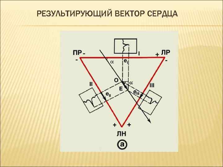 РЕЗУЛЬТИРУЮЩИЙ ВЕКТОР СЕРДЦА 