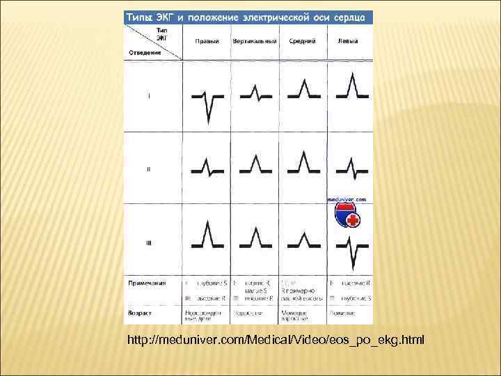 http: //meduniver. com/Medical/Video/eos_po_ekg. html 