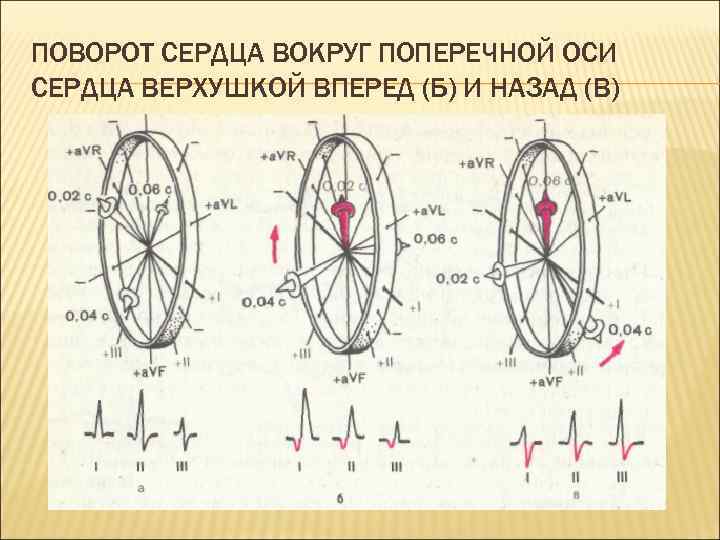 ПОВОРОТ СЕРДЦА ВОКРУГ ПОПЕРЕЧНОЙ ОСИ СЕРДЦА ВЕРХУШКОЙ ВПЕРЕД (Б) И НАЗАД (В) 
