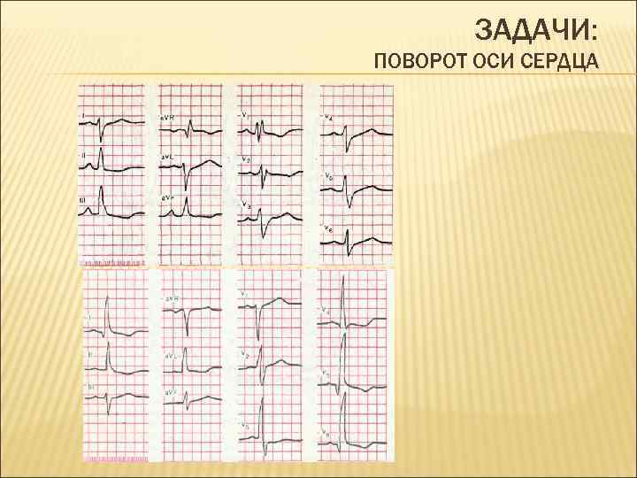 ЗАДАЧИ: ПОВОРОТ ОСИ СЕРДЦА 