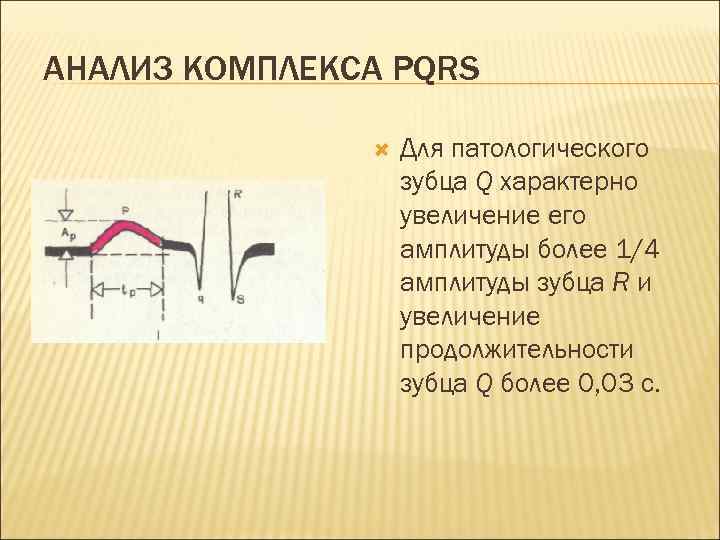 АНАЛИЗ КОМПЛЕКСА PQRS Для патологического зубца Q характерно увеличение его амплитуды более 1/4 амплитуды