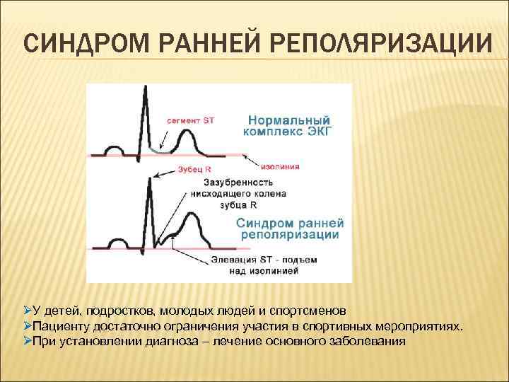 СИНДРОМ РАННЕЙ РЕПОЛЯРИЗАЦИИ ØУ детей, подростков, молодых людей и спортсменов ØПациенту достаточно ограничения участия