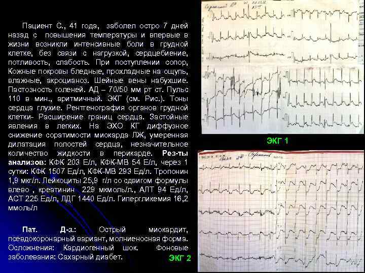 Пациент С. , 41 года, заболел остро 7 дней назад с повышения температуры и