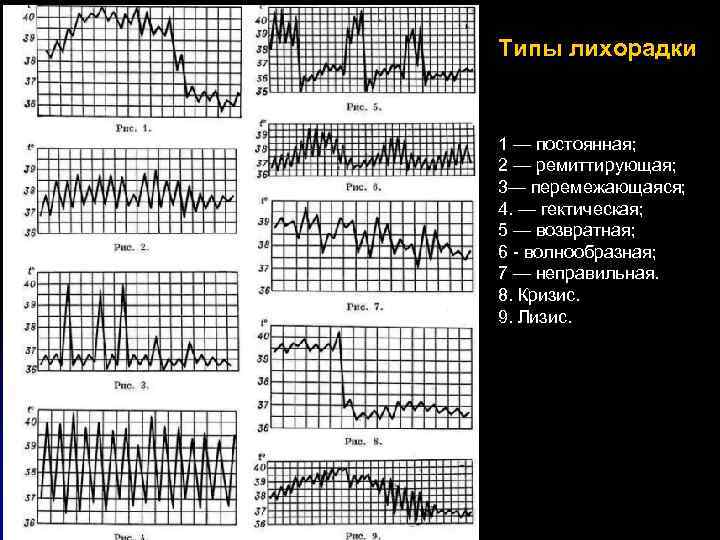 Типы лихорадки 1 — постоянная; 2 — ремиттирующая; 3— перемежающаяся; 4. — гектическая; 5