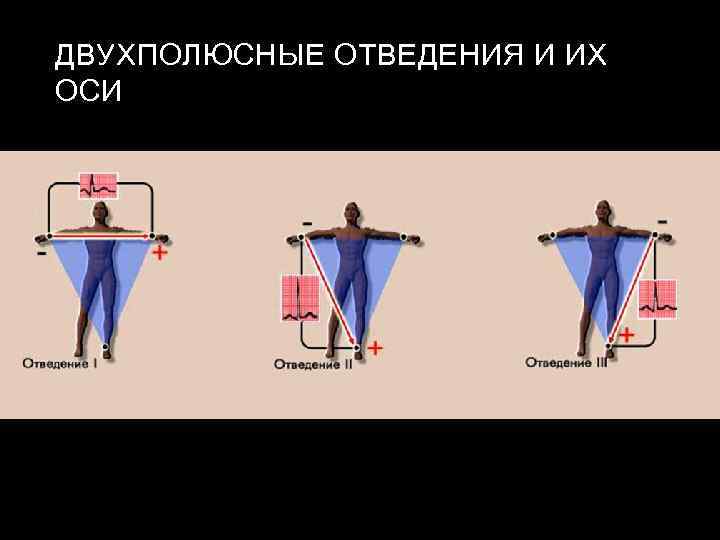 ДВУХПОЛЮСНЫЕ ОТВЕДЕНИЯ И ИХ ОСИ 