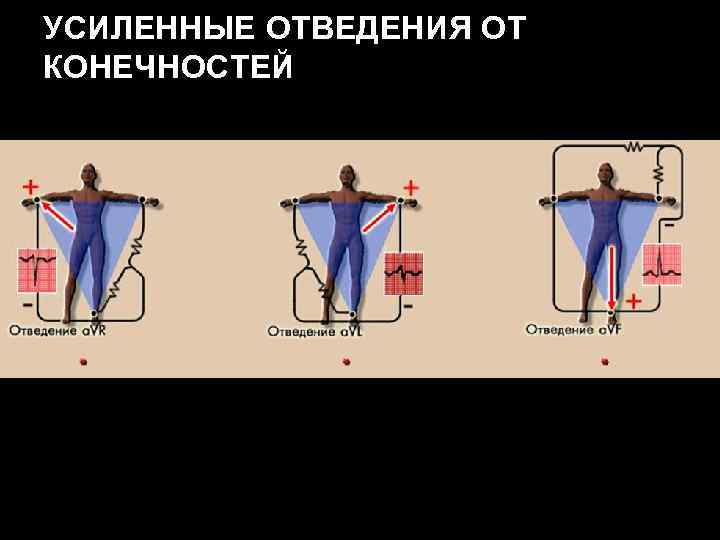 УСИЛЕННЫЕ ОТВЕДЕНИЯ ОТ КОНЕЧНОСТЕЙ 